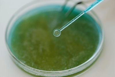 streptococcus agalactiae